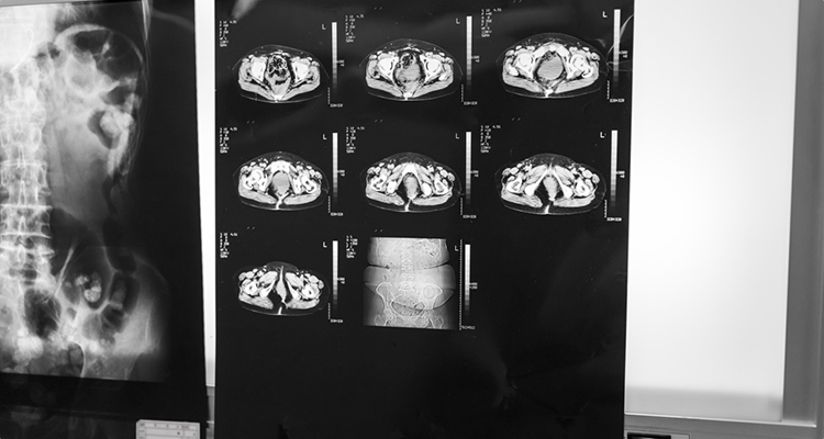 立体像(3D)、断層像(輪切り)を確認可能